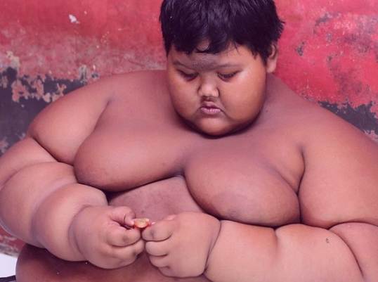 382 Days Without Food