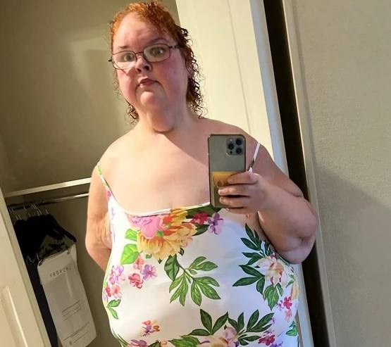  Yet Lost 250 Pounds!10 Comeback Stories That Shocked Millions of Netizens.